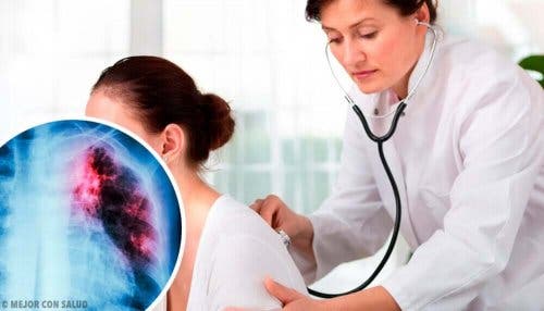 Keuhkopaise voi olla hyvänlaatuinen tai pahanlaatuinen.