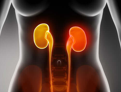 Hyperfosfatemia voi johtua munuaisten vajaatoiminnasta