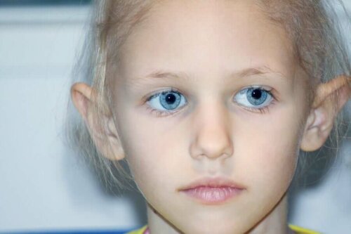 Retinoblastooma eli silmän verkkokalvon varhaissolusyöpä on onkologinen sairaus, joka on liitetty geenimutaatioon