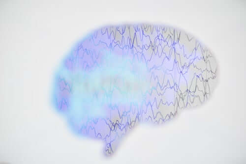 Epilepsia on krooninen, ei tarttuva aivosairaus, joka vaikuttaa kaikenikäisiin ihmisiin