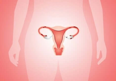 Kohdunrungon syövän hoito voi pitää sisällään kohdunpoiston.