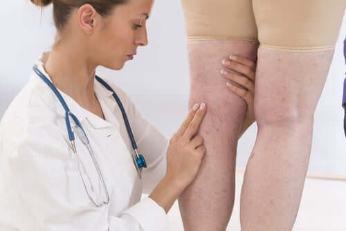8 oiretta, joita naisen ei kannata sivuuttaa: ongelmat jaloissa.