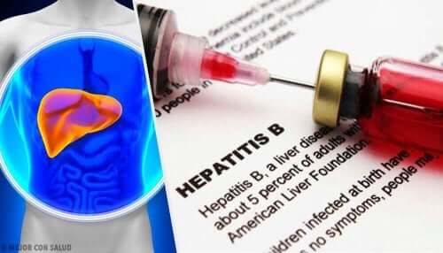 Yksi maksasairauksista on B-hepatiitti.