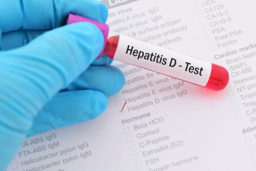 Hepatiitti D:n viruspartikkelia pidetään delta-aineena ja tästä syystä sen nimeen viitataan myös kirjaimella D