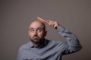Alopecian eri tyypit