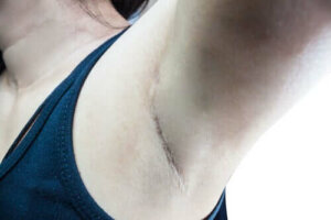 Mikä on vartijaimusolmuke?