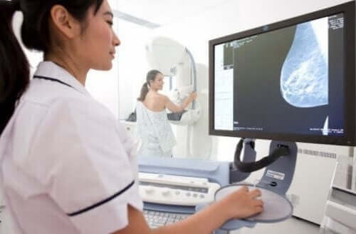 Rintasyövän seulontakokeet: mammografia.