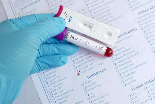 Maailman hepatiittipäivä keskittyy sairaudesta tiedottamiseen.