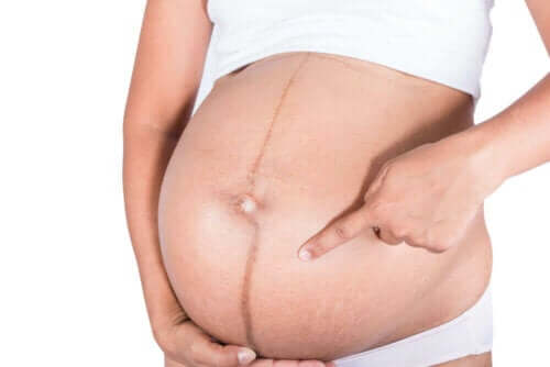 Iho muuttuu raskauden aikana monin tavoin.