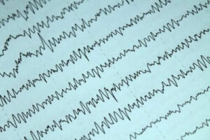 Imetys ja epilepsia: mitä tästä yhdistelmästä tulisi tietää?