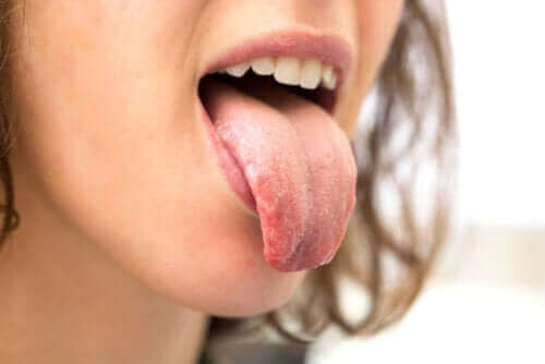 Miksi diabeetikot kärsivät suun kuivumisesta?