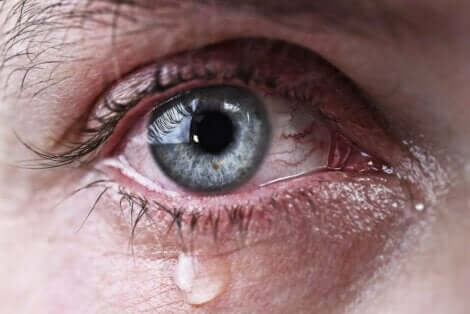 Vuotavat silmät ovat seurausta liiallisesta kyynelten muodostumisesta