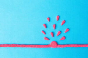 Vatsa-aortan pullistuma: oireet ja hoito