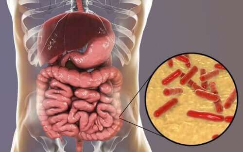 Suoliston mikrobiota: mistä tiedät sen vahingoittuneen?