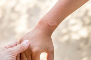 Mitä ovat ulkoloiset? Tietoa kirpuista ja punkeista