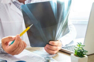 Luuydinödeema: mitä siitä tulisi tietää