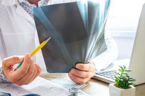 Luuydinödeema: mitä siitä tulisi tietää