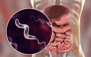 Kampylobakteeri-infektiot ja niiden ominaispiirteet