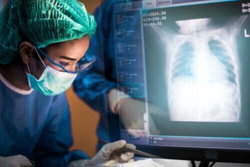 Keuhkonsiirto: mitä kaikkea siitä tulisi tietää?