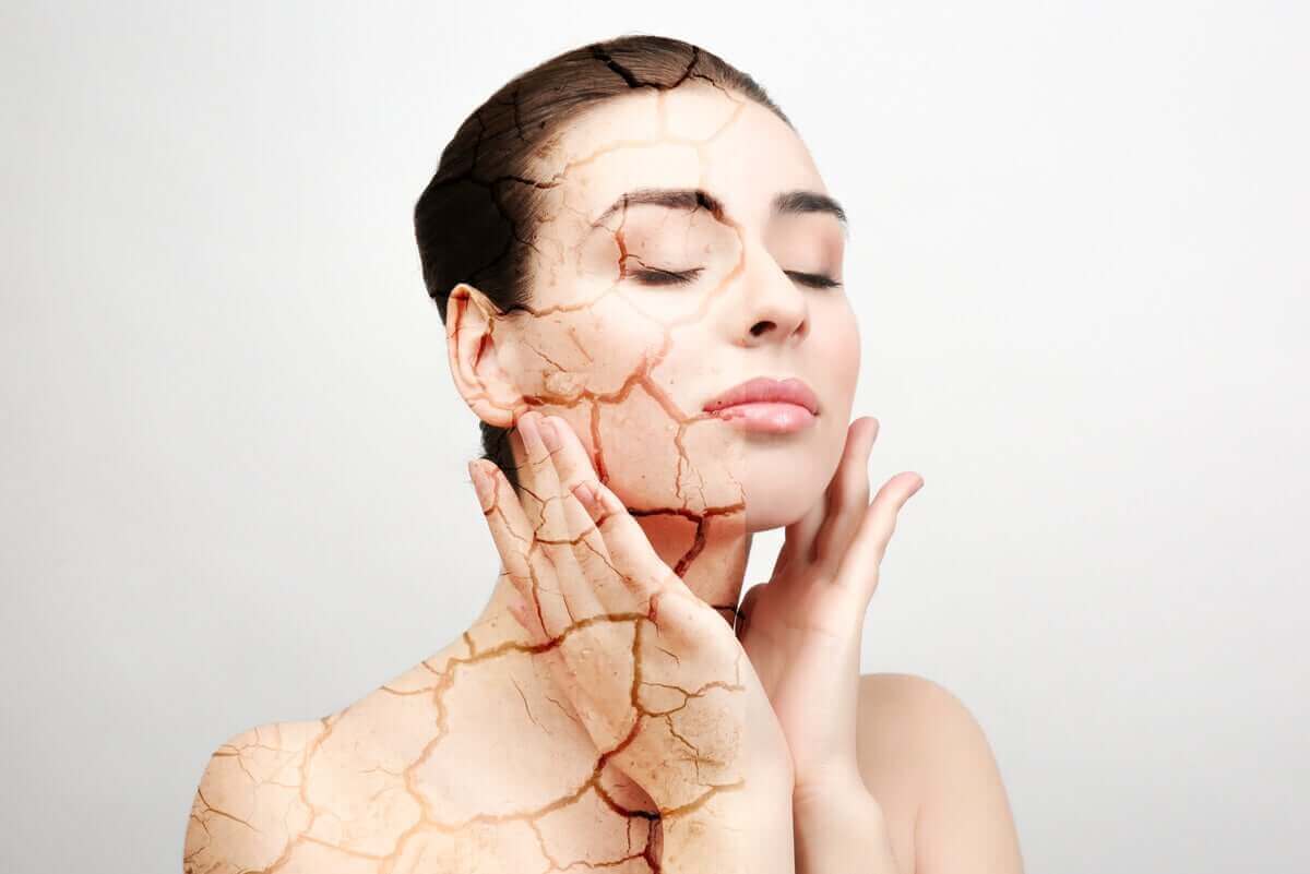 Mikä aiheuttaa ihon kuivumista?