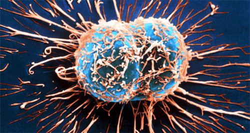 Näin immuunijärjestelmä taistelee syöpää vastaan