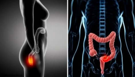 Peräsuolen tähystys on yleensä nopea toimenpide.