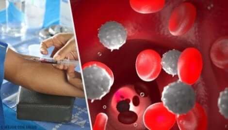 Jotkut ei-opioidiset kipulääkkeet voivat aiheuttaa agranulosytoosia