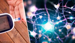 Eteerisiä öljyjä diabeetikoiden neuropatiaan