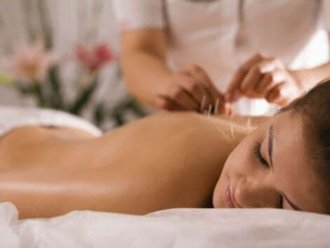 Akupunktio voi lievittää fibromyalgian oireita