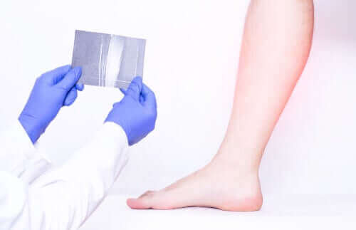 Miksi pohkeet kramppaavat?