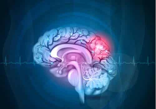 Aivojen ja mielen välillä on eronsa.