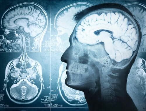 Aivojen rakenne ja erilaiset toiminnot
