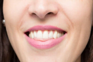 Mitä avopurenta tarkoittaa ja kuinka se voidaan korjata?