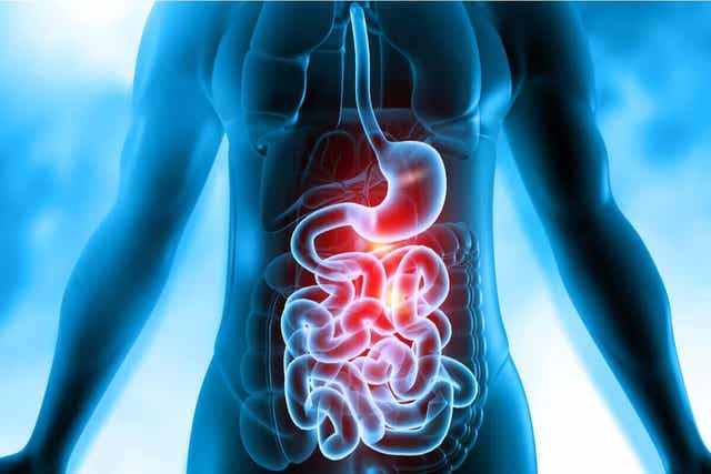 Ruoansulatuskanavan fisteli voidaan nähdä röntgenkuvissa.