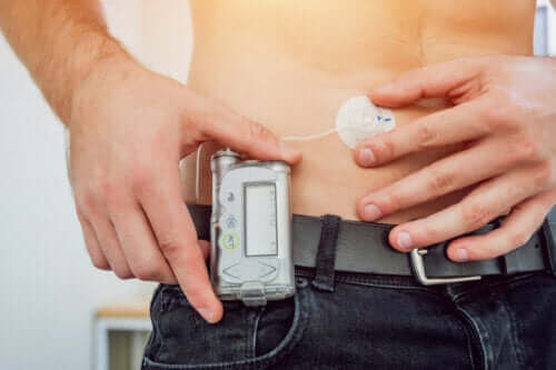 Mitä ovat insuliinipumput? Haitat ja hyödyt