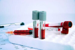Hematologiset sairaudet