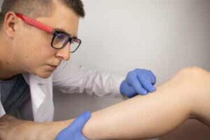 Luun ruhjevamma: syyt, oireet ja hoidot