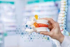 Mikä on välilevyn kuivuminen ja miten sitä hoidetaan?