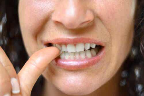 hampaiden terveyteen negatiivisesti vaikuttavat tekijät