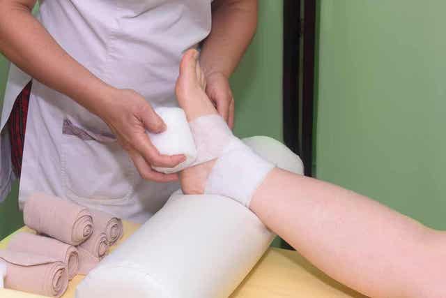 Isovarpaan tyvinivelen venähdystä hoidetaan puristussiteellä.