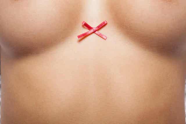 Rinnan rekonstruktio voidaan tehdä rintasyövän takia tehdyn mastektomian jälkeen