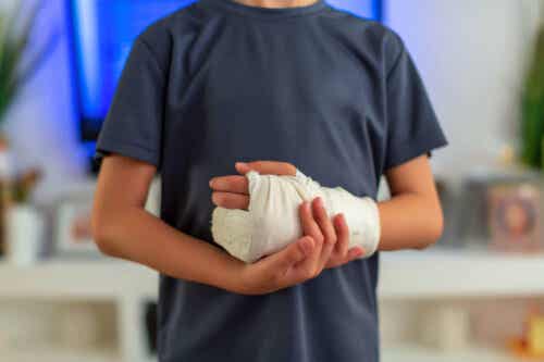 Dupuytrenin kontraktuura