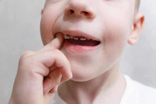 Jotkut hampaisiin liittyvät ongelmat vaativat pikaista hoitoa.