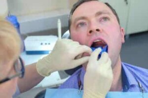 Miten fluori auttaa ehkäisemään hampaiden reikiä?