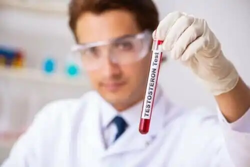 Testosteronitaso voidaan selvittää verikokeella.