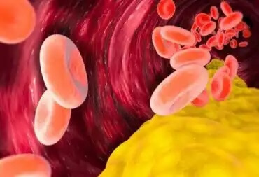 Onko VLDL-kolesteroli haitallista?