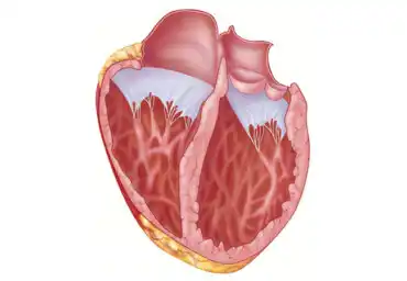Laajentunut sydän eli kardiomyopatia