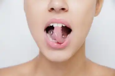 Suulävistysten vaikutuksia suun terveyteen