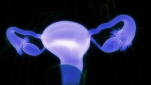 Munasarjan dermoidikysta: oireet ja milloin mennä lääkäriin