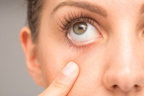7 vinkkiä silmäluomen lihaskramppien hoitamiseen